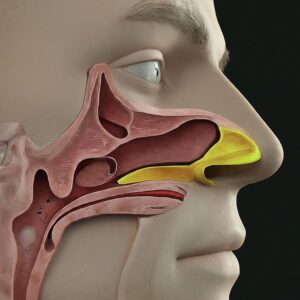 Nasal Mucus Plug